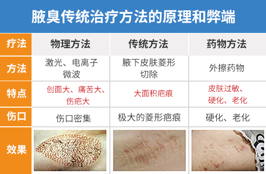 南京治疗腋臭如何选好医院？